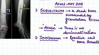 sequestrum involucrum and cloacae [upl. by Adekam]