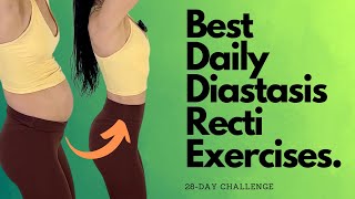 Heal amp Flatten With These Daily Diastasis Recti Exercises [upl. by Ennoid361]