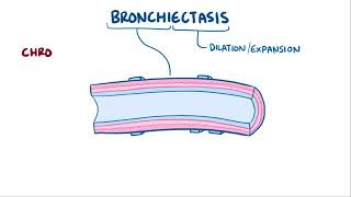 Bronchiectasis [upl. by Aoht]