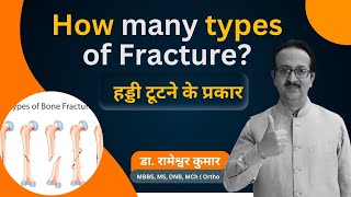 Common types of Bone fracture  Types of Fracture  How many types of Fracture fracture [upl. by Jelle761]