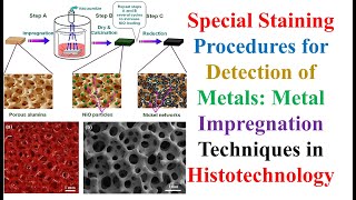 Staining Procedures for Detection of Metals Metal Impregnation Techniques in Histotechnology [upl. by May]