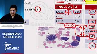 Hematología  12 Neoplasias Leucemias Agudas [upl. by Isherwood]