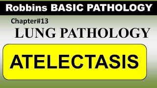 Chp13 Robbins Patho  Lung Pathology  ATELECTASIS [upl. by Llert862]