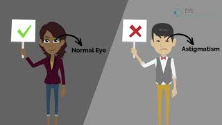 What is Astigmatism [upl. by Nyleve]