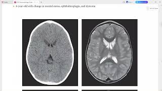 NEURORADIOLOGY OXFORD CASES [upl. by Bliss440]