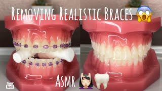 ASMR Orthodontist Gives You Braces 4K and realistic [upl. by Ettener]