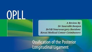 OPLLOssification of Posterior Longitudinal Ligament Diagnosis amp Management by Dr Saurabh Ranjan [upl. by Helmer]