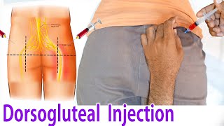 How to give an intramuscular IM injection in buttock hip at home dorsoglutel Injection technique [upl. by Thomsen]