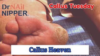 4 Minutes of Callus Heaven Callus Tuesday 2020 [upl. by Nolyak]