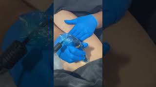 Esthetician performs cellulite treatment on the leg and thigh shorts [upl. by Borg]