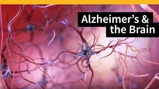 How Alzheimers Changes the Brain [upl. by Antonius]