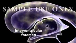 Ventricles of the Brain and CSF Flow Animationflv [upl. by Anayk]