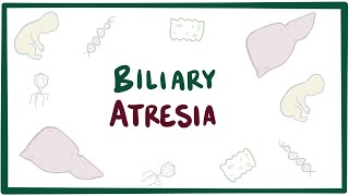 Biliary atresia  causes symptoms diagnosis treatment amp pathology [upl. by Relyuc258]