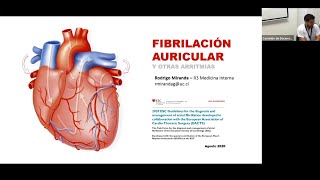 Fibrilación auricular y otras arritmias  Escuela de Verano 2023 [upl. by Bicknell]