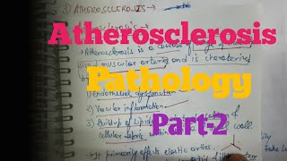 Atherosclerosis Part  2 Pathology [upl. by Swetiana686]