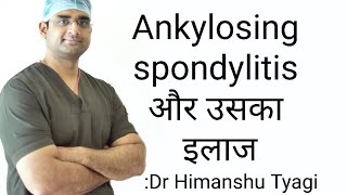 Ankylosing spondylitis और उसका इलाजTreatment [upl. by Salazar]