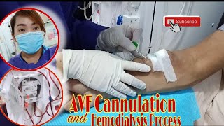 HEMODIALYSIS PROCESS AND AVF CANNULATION  Dialysis Nurse [upl. by Monty]