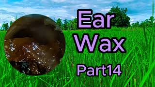 ear wax removal asmr [upl. by Aneerbas]