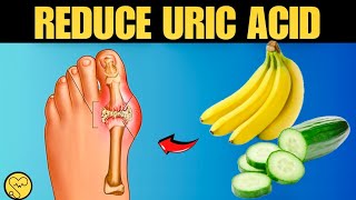 Reduce Uric Acid LevelsNaturally by Top 8 Foods  Vitalhealth6 [upl. by Ardeha]