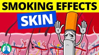 What Happens to Your Skin When You Quit Smoking [upl. by Elrebmik]