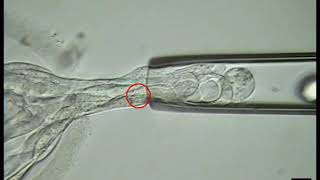 IVF  Embryo Biopsy Procedure Tests Embryos For Genetic Abnormalities [upl. by Anwadal]