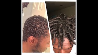 From Starter Locs To Dreadlocks 9 month Journey [upl. by Terence]