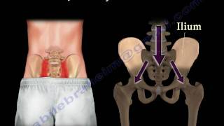 Sacroiliac Joint Dysfunction Animation  Everything You Need To Know  Dr Nabil Ebraheim MD [upl. by Frost]