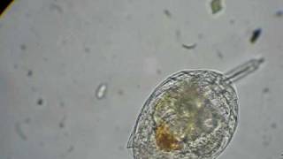 rotifer feeding on algae [upl. by Azmuh]