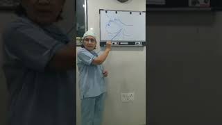 Use of Video Laryngoscope [upl. by Ramat]