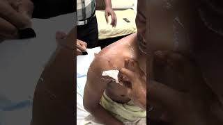 Arthroscopic shoulder surgery  Dr Jeya Venkatesh [upl. by Schwartz]