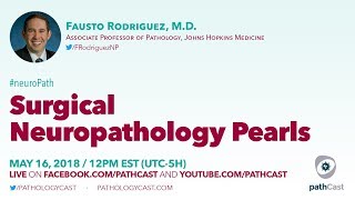 Surgical neuropathology pearls  Dr Rodriguez Hopkins NEUROPATH [upl. by Ettevroc]