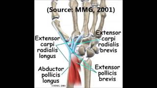 Intersection Syndrome of the wrist with ultrasound findings [upl. by Hujsak]