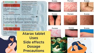 Atarax sr tablet uses in hindi  atarax sr 50 mg tablet  atarax side effects  atarax mrp [upl. by Pegg]