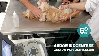 Abdominocentese guiada por ultrassom  procedimento minimamente invasivo [upl. by Maribel]