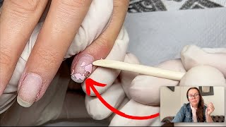 Can Shellac damage nails Nail technician explains what happens [upl. by Anna952]