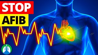 16 Ways Prevent AFib Before its Too Late to Protect Your Heart  NEVER IGNORE [upl. by Blasien]