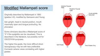 Anaesthetic airway assessment [upl. by Yazbak766]