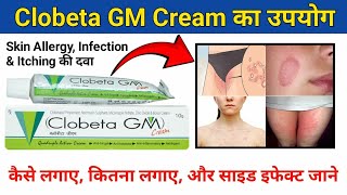 Clobeta GM l दादखाद खुजली कि दवा l Anti Fungal Anti Bacteria l लगाने से पहले वीडियो देख लें [upl. by Aelam908]