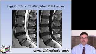 Dr Gillard lectures on How to Read Your Lumbar MRI [upl. by Estrellita]