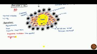 Tuberculosis for USMLE Step 1 and USMLE Step 2 [upl. by Skilken]