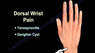 WRIST PAIN COMMON CAUSES  Everything You Need To Know  Dr Nabil Ebraheim [upl. by Hellah891]