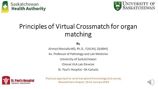 Principles of Virtual Crossmatch for solid Organ Matching [upl. by Enowtna]