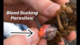 Removing Huge Blood Sucking Parasites part 4 NEW Episode [upl. by Ellenaj]