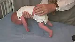 418  Positions Ventral Suspension  Newborn Abnormal  Infant Clinical ExaminationMRCP [upl. by Macilroy]