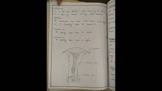 cervical cancer nursing care plan on cervical cancer NCP [upl. by Juliet]