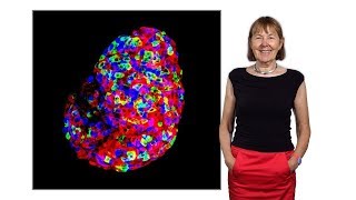 Frances Ashcroft Oxford 1 Diabetes a global pandemic [upl. by Newol]