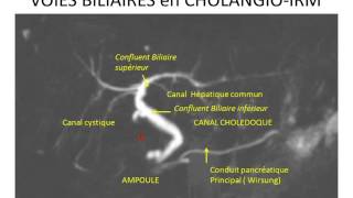 foie et voies biliaires 2 partie 3 [upl. by Rabelais]