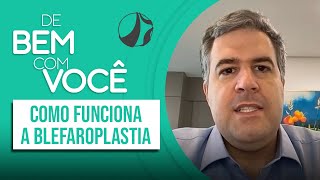 Cirurgia para retirar o excesso de pele das pálpebras  De Bem com Você [upl. by Akinom]