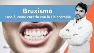 Bruxismo  Cosa Ã¨ come curarlo DEFINITAMENTE [upl. by Ferrigno]