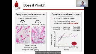 FA Connect Eltrombopag Clinical Trial Update 2022 [upl. by Nosak]